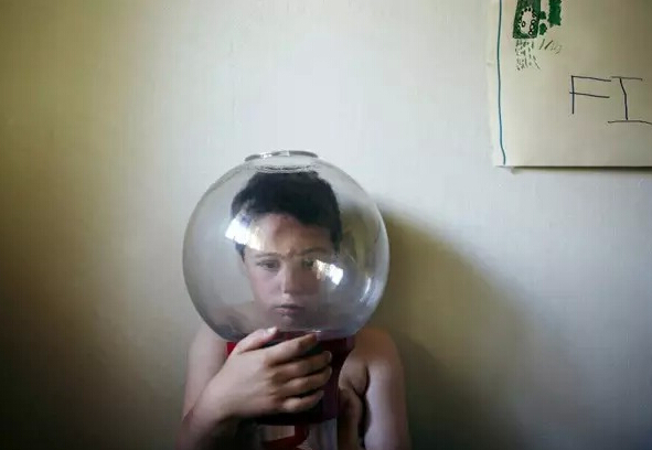 自闭症患者都有哪些明显的症状